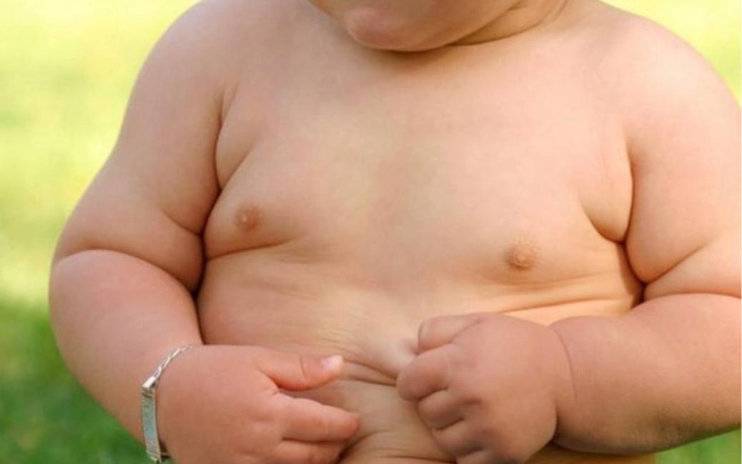 immagine di un bambino obeso